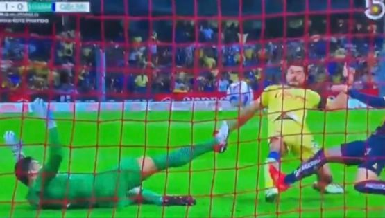 ¡Clásico rudo! Henry Martín muestra la herida que le dejó la PLANCHA de Pumas 