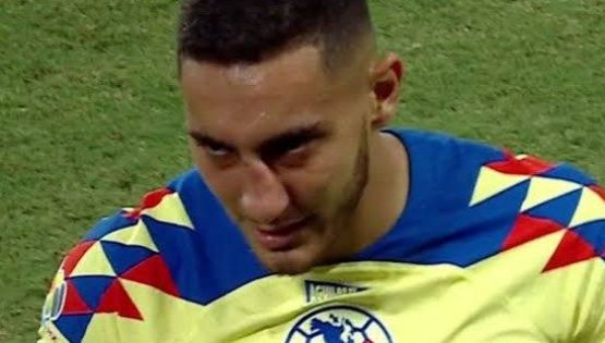 ¿Qué PASÓ con la lesión en la nariz de Sebastián Cáceres?