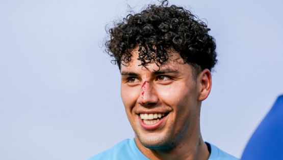 Jorge Sánchez sufre FUERTE HERIDA en la nariz en el entrenamiento del FC Porto