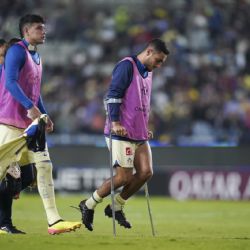 América cambia de estrategia ante sus CONSTANTES LESIONES