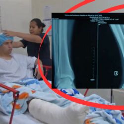 Doctor de los Tuzos del Pachuca recuerda cómo fue atender una de las lesiones más graves que sufrió Víctor Dávila cuando estuvo en la Bella Airosa