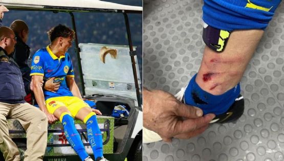 Igor Lichnovsky explica las GRAVES CONSECUENCIAS que pudo tener por CRIMINAL ENTRADA en el Pumas vs América