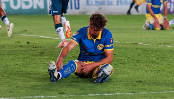 El mensaje de Igor Lichnovsky que DEJABA VER la GRAVEDAD de su lesión